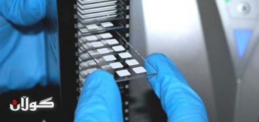 New Method For Early Cancer Diagnosis