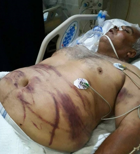 Çekdaran welatiyekî Efrînê êşkencekirin