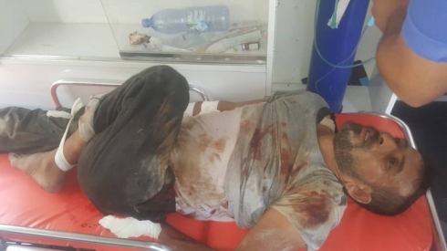 Artêşa Tirkiyeyê du welatiyên Kurd birîndar kir