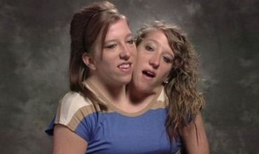 Doktoran digot ewê çend rojan bijîn...