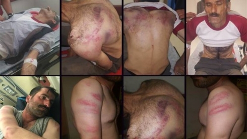 Artêşa Tirkiyê rehimê bi şiwanan jî nekir