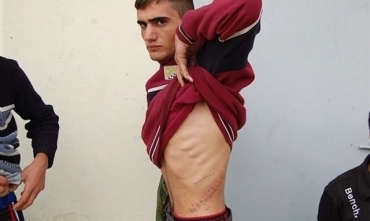 “Dû zarok revandin û gurçikên wan dizîn”