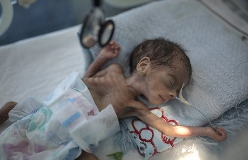 UNICEF: Millions of Yemeni children may starve amid pandemic