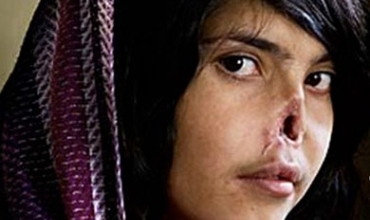 Baştirîn xelata wêneya salê wergirt