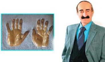 Li Swêdê destên wî ji zêr hatin çêkirin