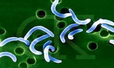 Li Silêmaniyê 150 rewşên kolera hatin tomarkirin