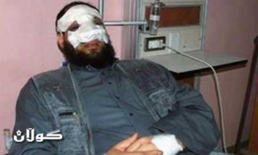 Egypt’s Islamist party sacks MP for getting a nose job