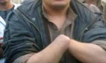 xortekî Misirê Ji bo ku dizyê neke destê xwe qut kir