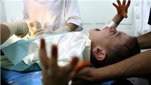 پزیشكێك ئەندامی نێرینەی دوو منداڵ دەبڕێت