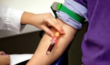 Li başûrê Kurdistanê pişkinîna nexweşiyên sêksî bi awayekî veşartî tê kirin