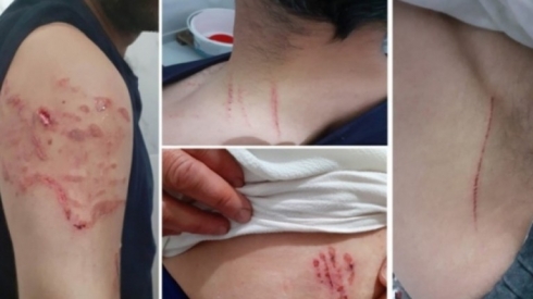 Polîs seh berda canê 5 girtiyên Kurd