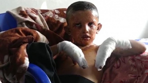 Amnesty International: Tirkiye tawanên cengî dijî Kurd kiriye