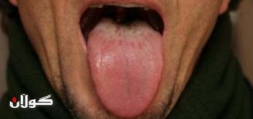 A man's tongue cut off by his wife in Chwarqurna