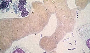 Scientists crack Black Death's genetic code