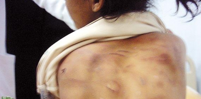 باوه‌ژنێك له‌ باشوورى عێراق كچى مێرده‌كه‌ى به‌ئاوى كوڵاو كوشت 