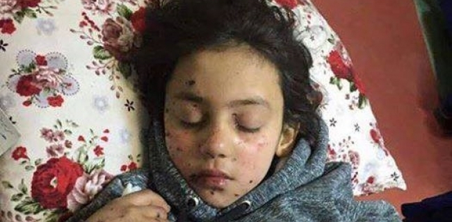 منداڵێكى بریندار به‌ته‌نها و بێكه‌س له‌ نه‌خۆشخانه‌ى هه‌ولێر خه‌وێندراوه‌ 