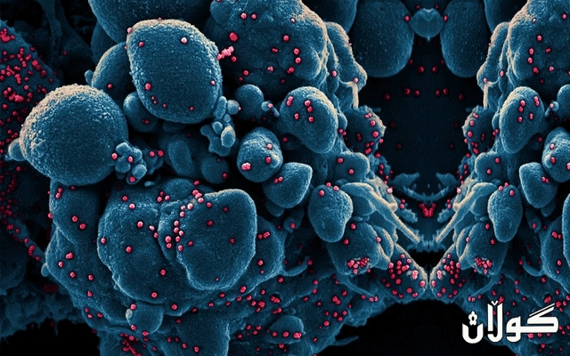 جۆرێكی دیكه‌ی كرۆنا ڤایرۆس به‌ناوی (سادس-كۆڤید) بڵاوده‌بێته‌وه‌