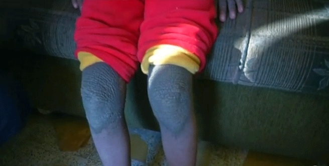 داعش بەردەوامە لە بەکارھێنانی چەکی کیمیایی