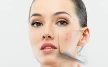 سوودێکی گرینگی زیبکە 