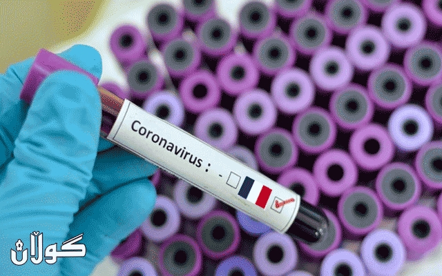  کۆمپانیایەکی فەرەنسی: دەرمانی دژە کۆرۆنا بە سەرکەوتوویی تاقی کرایەوە 