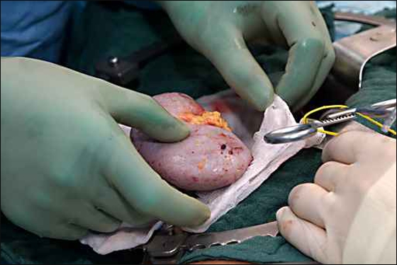 دیاردەی گورچیلە دزین لە موسڵ پەیدا بووە