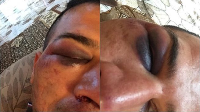 ھێزەكانی عێراق لەسەر ئاڵای كوردستان دوو پێشمەرگە ئەشكەنجە دەدەن