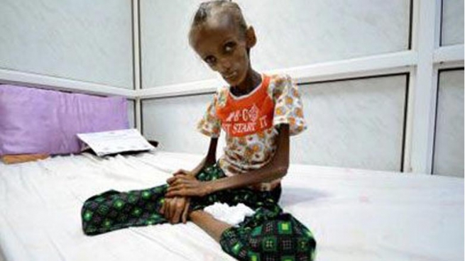 بۆچی نه‌ته‌وه‌ یه‌كگرتووه‌كان ده‌یه‌وێت ئه‌م وێنه‌یه‌ پیشانی جیهان بدات