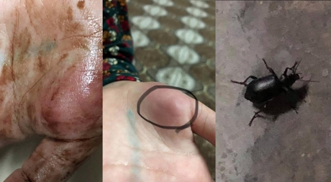 ڕوونکردنەوە لەبارەی پەیدابوونی جۆرە مێروویەک دەدرێت
