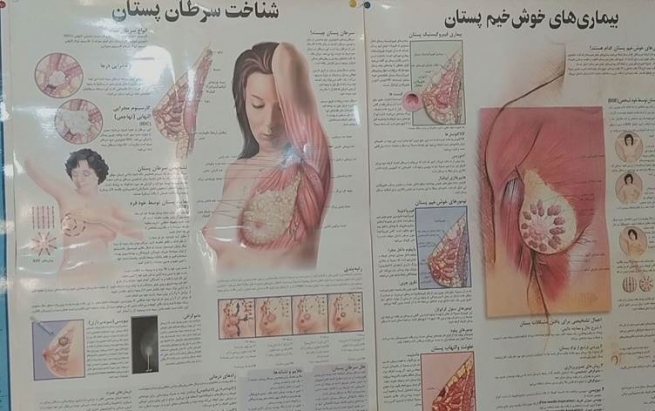 لە ئێران هەر 36 خولەکێک ژنێک تووشی شێرپەنجەی مەمک دەبێت