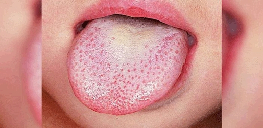 رەنگی زمان چی بە تەندروستیت دەڵێت!