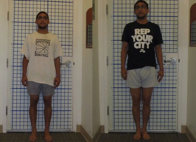 نەشتەرگەریی بەرزکردنی باڵا پەرەدەسەنێت