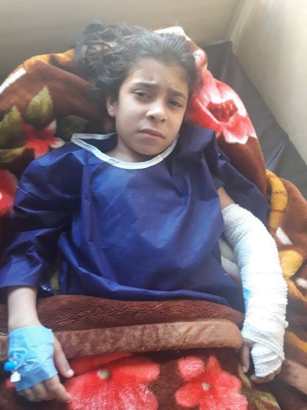 کچێک ماوەی 7 ساڵە زیادەئێسک لە لەشی دروست دەبێت