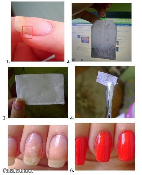  2 رێگا بۆ چاككردنەوەی نینۆكی شكاو