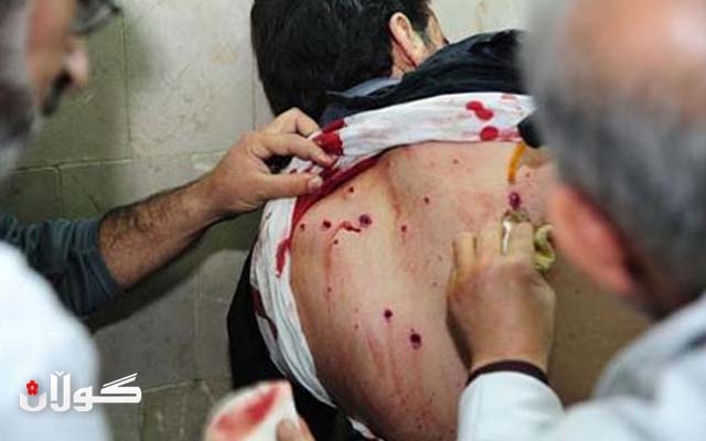  چالاكانی‌ ئۆپۆزسیۆن زیاتر له‌ 560 كه‌س بە چەکی کیمیایی كوژراون 