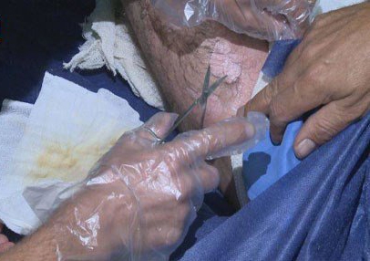  وەزارەتی بەرگری ئەڵمانیا: داعش چەکی کیمیایی لە دژی پێشمەرگە بەکارهێناوە 