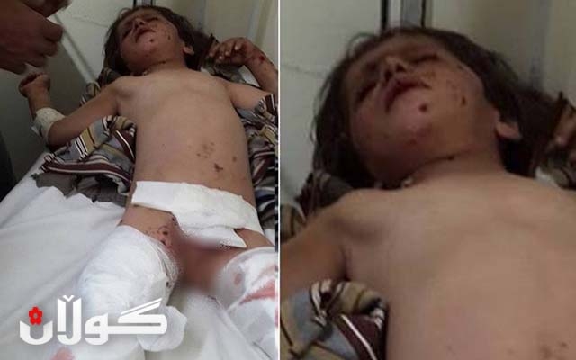  تەقینەوەی مین لە مەریوان 7 منداڵی بە سەختی برینداركرد