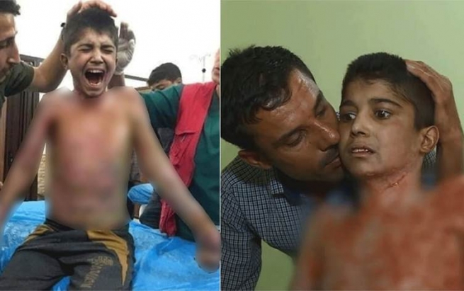 منداڵە سووتاوەکەی رۆژئاڤای کوردستان لە فەرەنسا لەژێر چاودێریی پزیشکیدایە