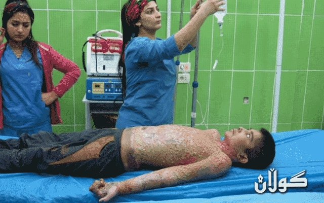  لەسەر راسپاردەی سەرۆک بارزانی منداڵە بریندارەکەی ڕۆژئاوای کوردستان ڕەوانەی فەڕەنسا دەکرێ 