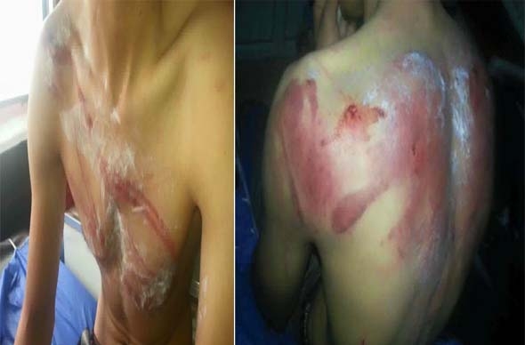 لە دوز خورماتوو حەشدی شەعبی پێشمەرگەیەک بە تودی سزا دەدەن