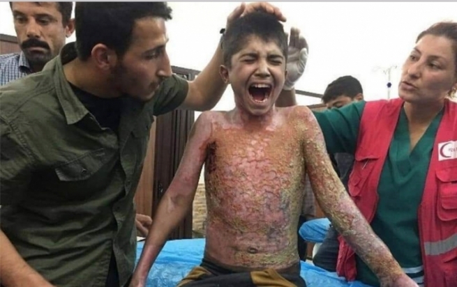 ئەندامانی کۆنگرێس لێکۆڵینەوە لە بەکارهێنانی چەکی فسفۆڕی لەلایەن تورکیاوە دژی کورد دەکەن