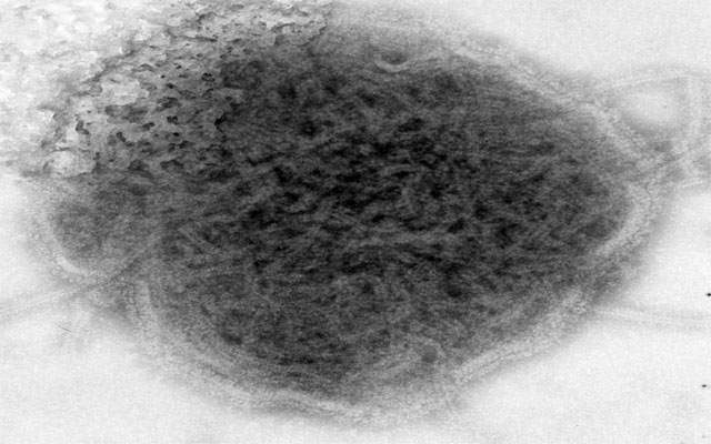 ئه‌م ڤایرۆرسه‌ 7 هه‌زار كه‌سی له‌ به‌غدا تووشی نه‌خۆشی كردووه‌ ‌