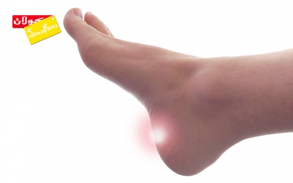 زێدە ئێسكی پاژنەی پێ