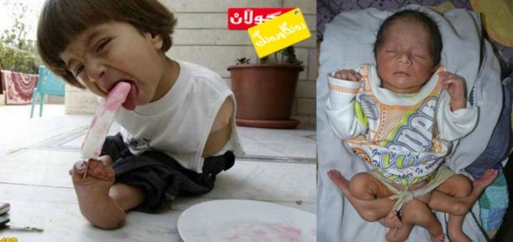 دوو منداڵی سەیر بە دەست و قاچەكانیانەوە