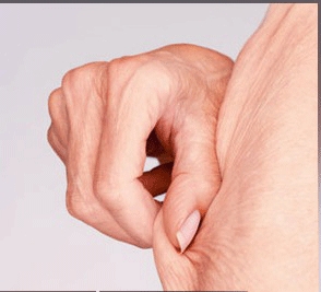 چۆن خۆت لەم ھێڵە سپیانەی پێست رزگاردەکەی