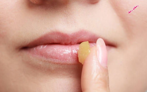 كرێمی تەڕكردنی لێو