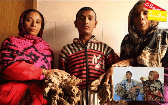 پیاوی دار بێ چارەسەرە !