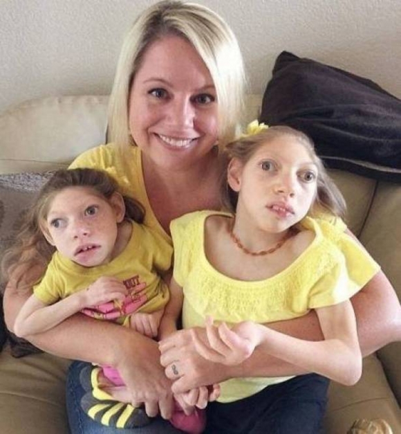 به‌هۆی هه‌ڵه‌یه‌كی دایكیانه‌وه‌ كه‌م ئه‌ندام بوون