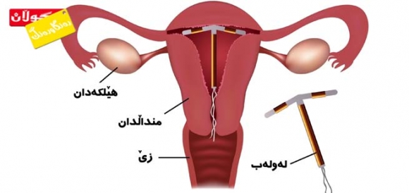 ئەگەری دووگیانی پاش دانانی لەولەب