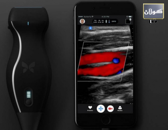 ئامێری سۆنەری مۆبایل