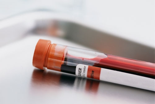 ئاستی بەرزی هیمۆگلۆبین